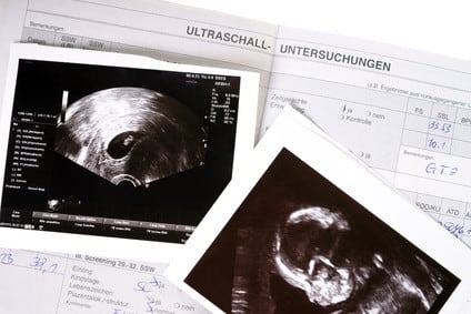 Mutterpass und Ultraschallbild